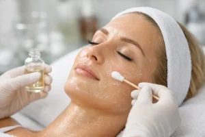 Lee más sobre el artículo Cómo funciona un peeling químico de verdad